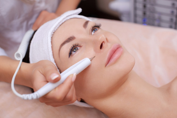 Frederick area dermatologist explains dermal needling therapy for acne scars