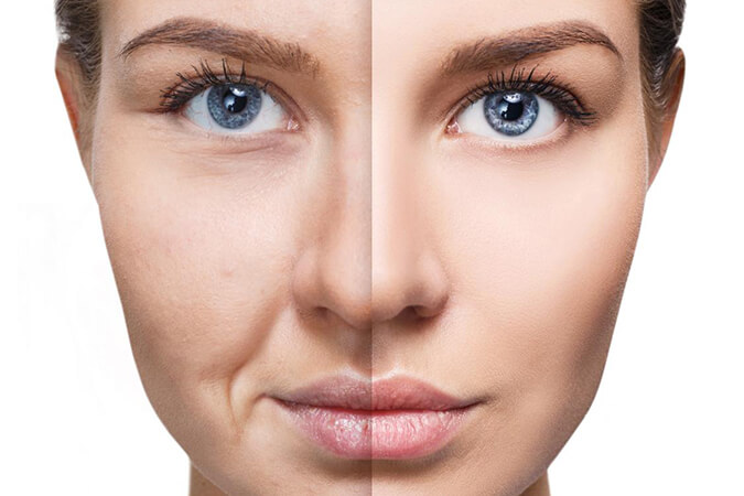 Dermatologist near Potomac area reviews the cost and benefits of laser treatments for skin rejuvenation