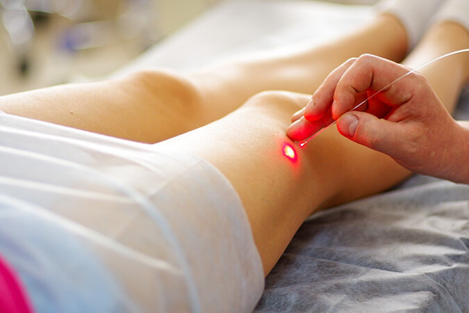 Rockville dermatologist offers laser procedures for your skin care needs