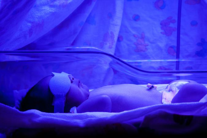Why phototherapy treatment is chosen by Kensington area psoriasis patients