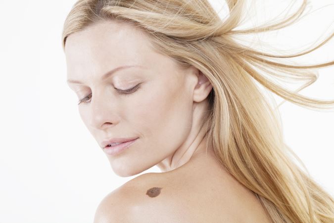 Germanton dermatologist discusses prevention from skin cancer and damage caused by the elements