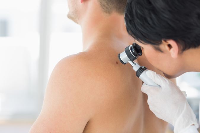 Your skin cancer dermatologist near Silver Springs MD offer 10 ways to decrease your risk of skin cancer