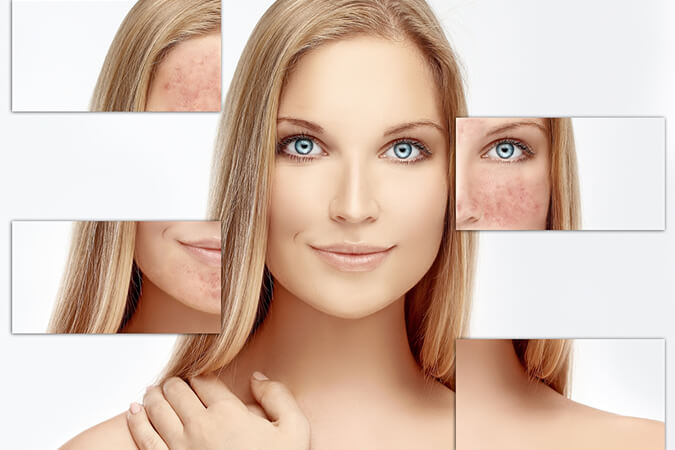 Dermatologist brings relief to residents of Rockville suffering from symptoms of rosacea
