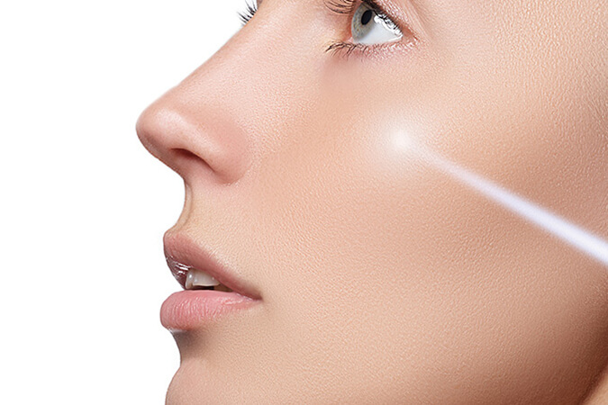 Frederick area patients ask, what is IPL laser therapy?