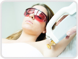Laser Hair Removal