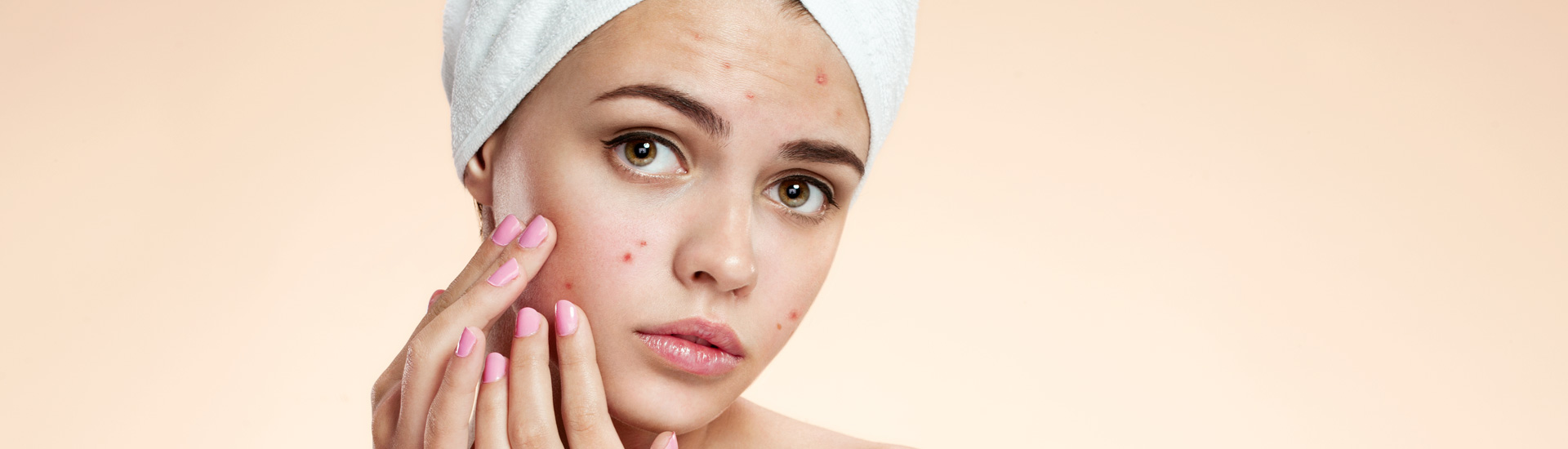 Teenage girl removing pimple from her face