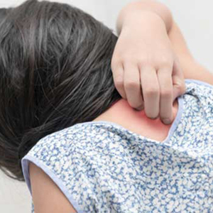 Dermatologist in Huntington, NY explains eczema and psoriasis and ways to prevent them this winter