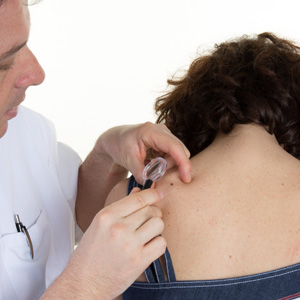 Does a red mole require removal by your dermatologist in Huntington, NY?