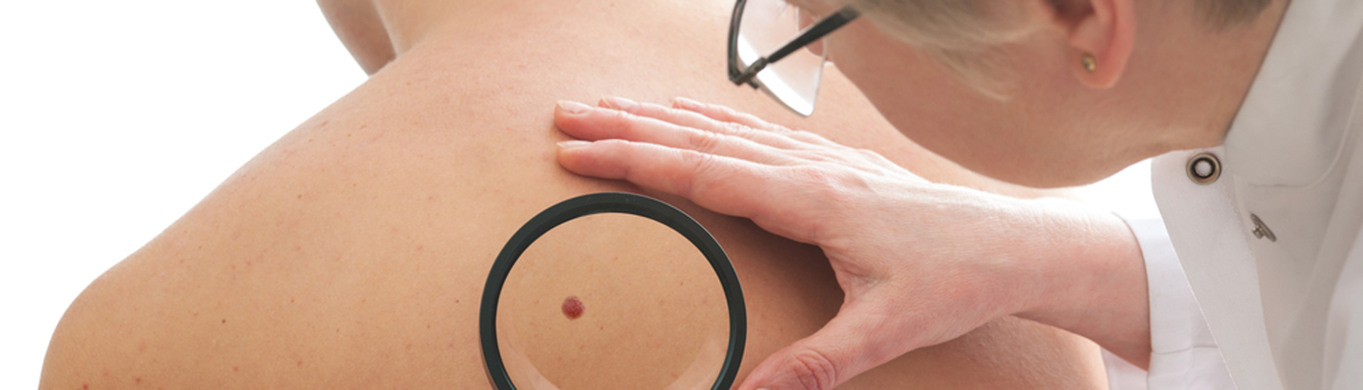 Doctor is checking skin of patient