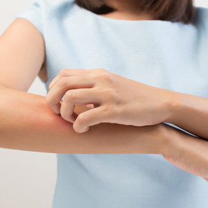 Proper identification key to treating skin rashes in Huntington, NY