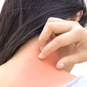 We answer the question what are the causes of heat rash during consultation in our Huntington NY office