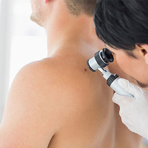 Huntington area dermatologist offers pre skin cancer screenings