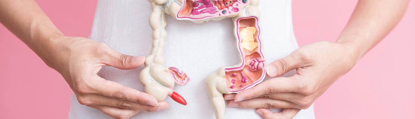 Colorectal Cancer, FL