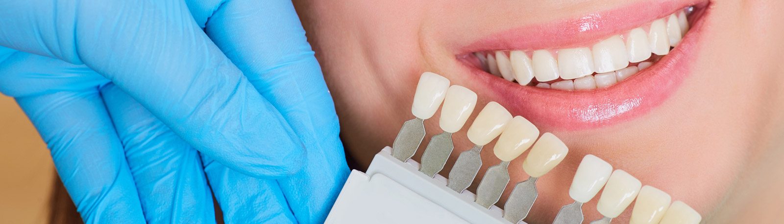 Dental Crowns, FL