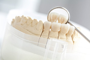 <?php echo $pk;?> - Illustration of Dental Bridge