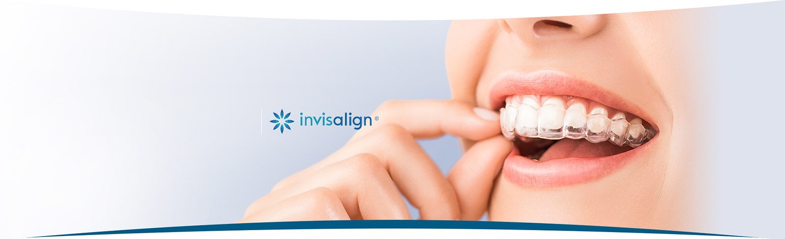 Invisalign, MI