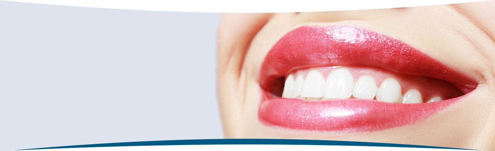 Tooth Colored Fillings, MI