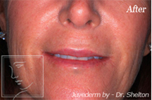 Before and After Austin - Case Study 2