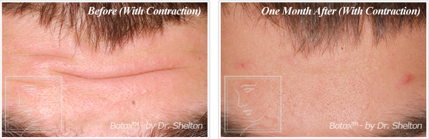 <?php echo $phone; ?> - Before and After