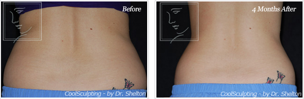 <?php echo $pk; ?> - Before and After