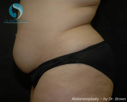 <?php echo $pk; ?> - Before Case 19