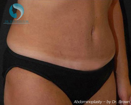 <?php echo $pk; ?> - After Case 5