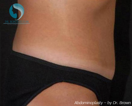 <?php echo $pk; ?> - After Case 6