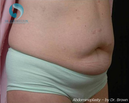 <?php echo $pk; ?> - Before Case 5