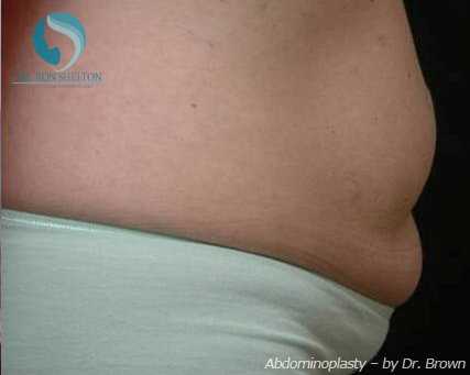 <?php echo $pk; ?> - Before Case 6