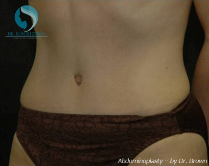 <?php echo $pk; ?> - After Case 8