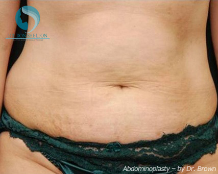 <?php echo $pk; ?> - Before Case 7