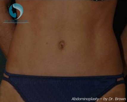 <?php echo $pk; ?> - After Case 20