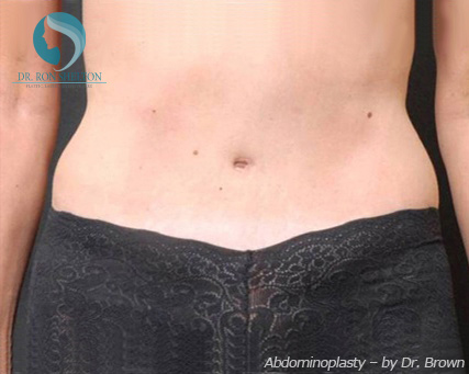 <?php echo $pk; ?> - After Case 1