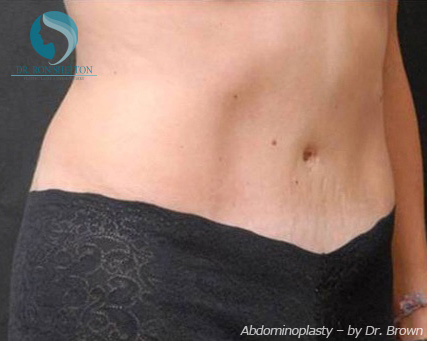 <?php echo $pk; ?> - After Case 2