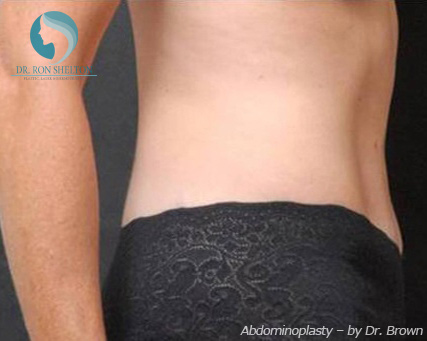 <?php echo $pk; ?> - After Case 3