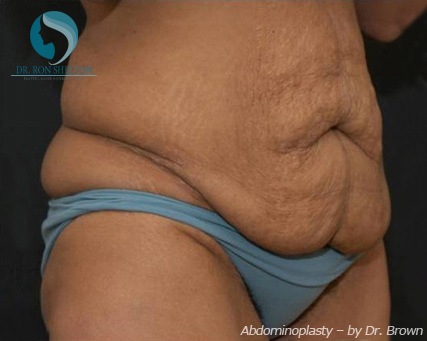 <?php echo $pk; ?> - Before Case 11