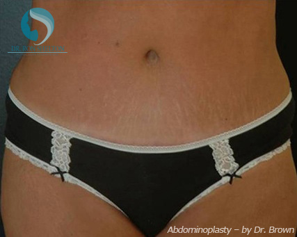 <?php echo $pk; ?> - After Case 9