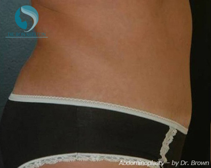 <?php echo $pk; ?> - After Case 10