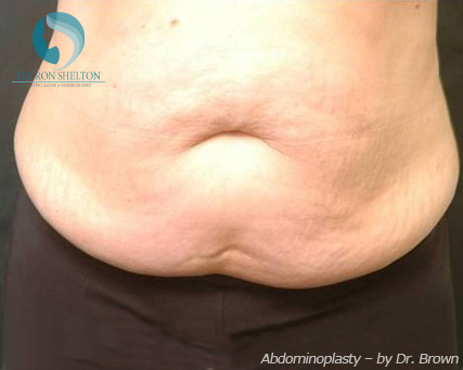 <?php echo $pk; ?> - Before Case 9