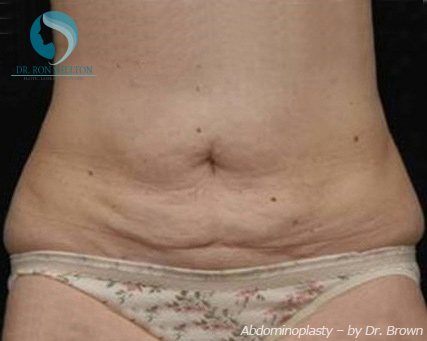 <?php echo $pk; ?> - Before Case 14