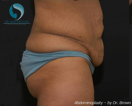 <?php echo $pk; ?> - Before Case 12