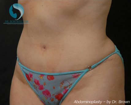 <?php echo $pk; ?> - After Case 18