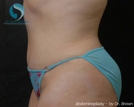 <?php echo $pk; ?> - After Case 19