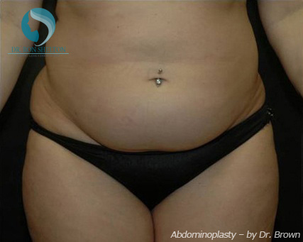 <?php echo $pk; ?> - Before Case 16