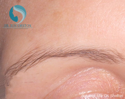 <?php echo $pk; ?> - After Case 5