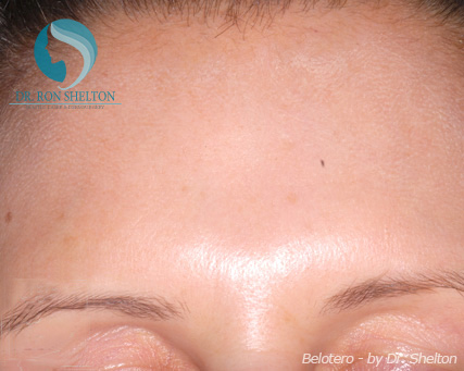 <?php echo $pk; ?> - After Case 5