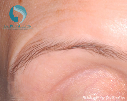 <?php echo $pk; ?> - Before Case 5