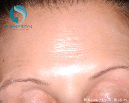 <?php echo $pk; ?> - Before Case 5