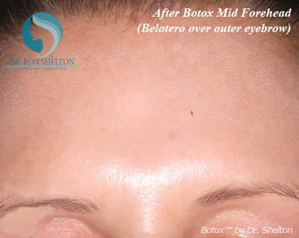 <?php echo $pk; ?> - After Case 7