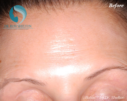 <?php echo $pk; ?> - Before Case 7